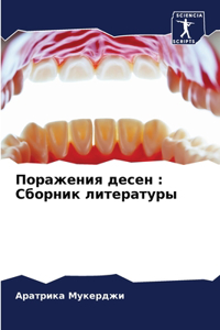 Поражения десен