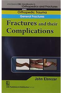 Fractures And Their Complications (Handbook In Orthopedics And Fractures Vol.3 - Orthopedic Trauma General Fractures)