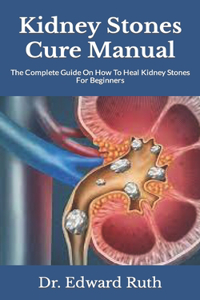 Kidney Stones Cure Manual