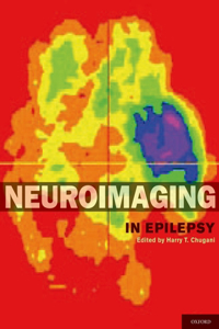 Neuroimaging in Epilepsy