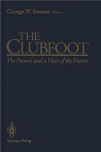 Clubfoot