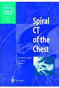 Spiral CT of the Chest