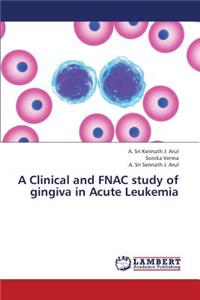 Clinical and Fnac Study of Gingiva in Acute Leukemia
