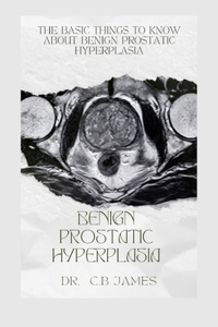 Benign Prostatic Hyperplasia