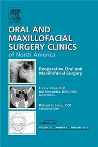 Reoperative Oral and Maxillofacial Surgery, an Issue of Oral and Maxillofacial Surgery Clinics