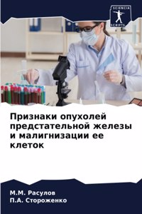 Признаки опухолей предстательной желез