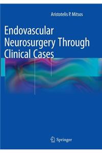 Endovascular Neurosurgery Through Clinical Cases