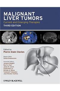 Malignant Liver Tumors