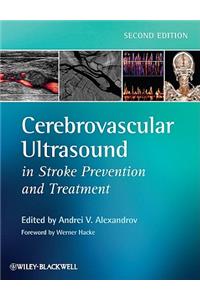 Cerebrovascular Ultrasound in Stroke Prevention and Treatment