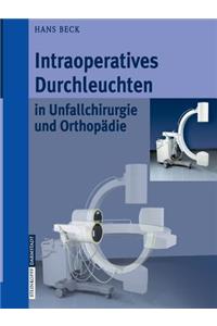 Intraoperatives Durchleuchten in Unfallchirurgie Und Orthopädie