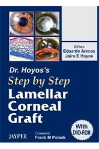 Dr Hoyos’s Step by Step Lamellar Corneal Graft (with DVD-ROM)