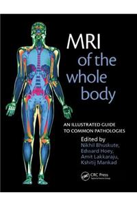 MRI of the Whole Body