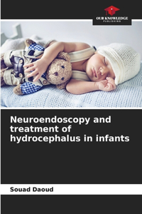 Neuroendoscopy and treatment of hydrocephalus in infants