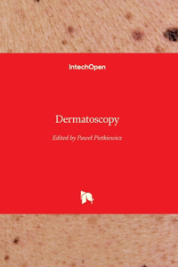 Dermatoscopy