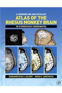 A Combined MRI and Histology Atlas of the Rhesus Monkey Brain