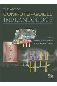 The Art of Computer-guided Implantology