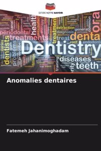 Anomalies dentaires