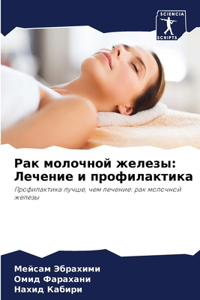 Рак молочной железы