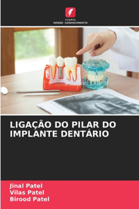 Ligação Do Pilar Do Implante Dentário