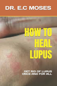 How to Heal Lupus