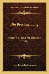 Beschneidung