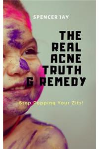 The Real Acne Truth & Remedy