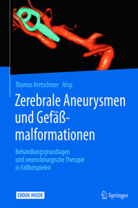 Zerebrale Aneurysmen Und Gefäßmalformationen