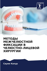 МЕТОДЫ МЕЖЧЕЛЮСТНОЙ ФИКСАЦИИ В ЧЕЛЮСТНО-Л