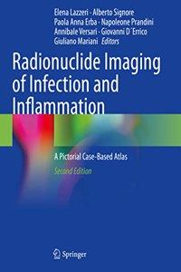 Radionuclide Imaging of Infection and Inflammation