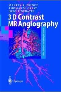 3D Contrast Mr Angiography