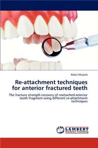 Re-attachment techniques for anterior fractured teeth