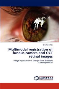 Multimodal registration of fundus camera and OCT retinal images