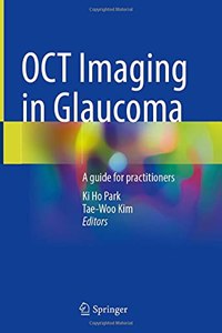 OCT Imaging in Glaucoma