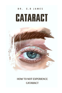 Cataract