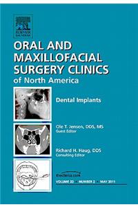 Dental Implants, an Issue of Oral and Maxillofacial Surgery Clinics