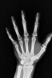 X-Ray Hand Journal