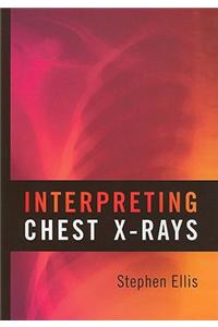 Interpreting Chest X-Rays