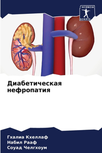 Диабетическая нефропатия