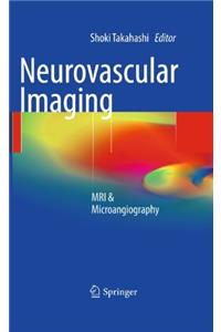 Neurovascular Imaging