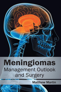 Meningiomas: Management Outlook and Surgery