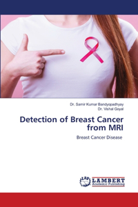 Detection of Breast Cancer from MRI