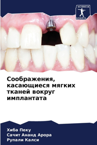 Соображения, касающиеся мягких тканей вl