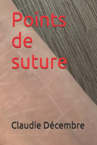 Points de suture