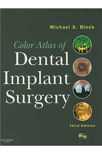 Color Atlas of Dental Implant Surgery