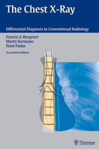 Differential Diagnosis in Chest X-Rays