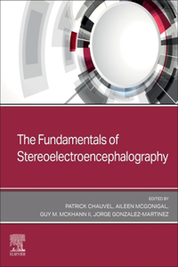 Fundamentals of Stereoelectroencephalography