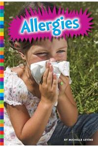 Allergies