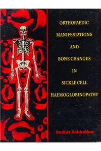 Orthopaedic Manifestations and Bone Changes in Sickle Cell Haemoglobinopathy