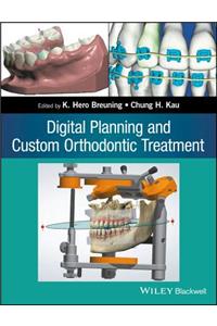 Digital Planning and Custom Orthodontic Treatment