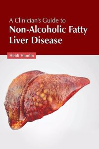 Clinician's Guide to Non-Alcoholic Fatty Liver Disease